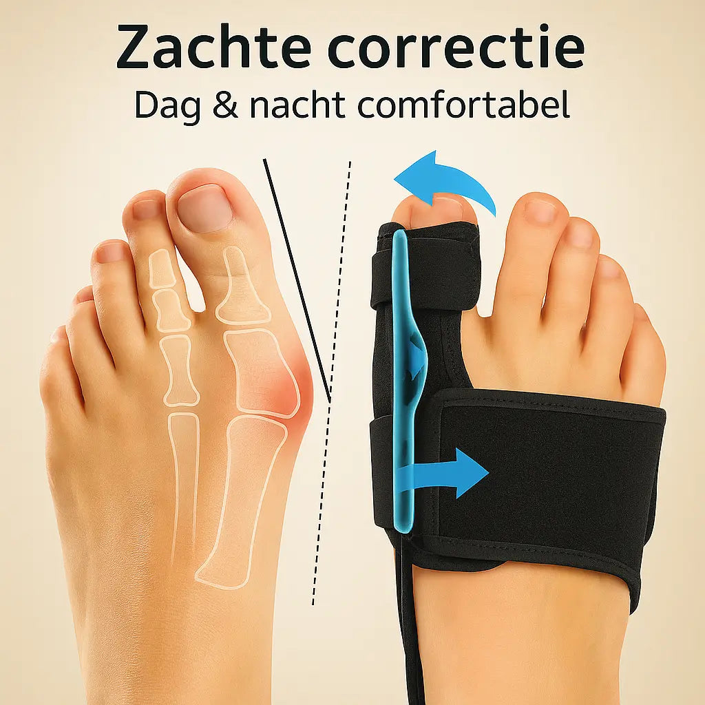 Zachte Teen Corrector - Advero Zachte Teen Corrector bunion hallux valgus teen corrector knobbel knobbelpijn knobbelvoet