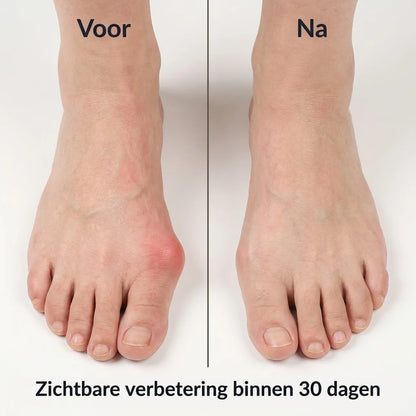 Zehenkorrekturgerät