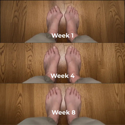 Soft Toe Corrector™